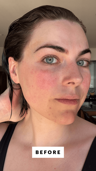 Dall'Asen before applying the Sulwhasoo First Care Activating Serum