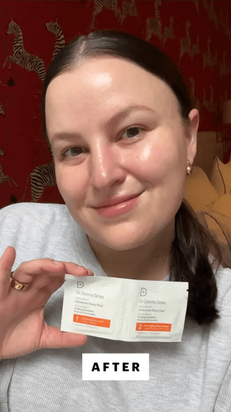 Allure features director Dianna Singh after applying the Dr. Dennis Gross Alpha Beta Universal Daily Peel